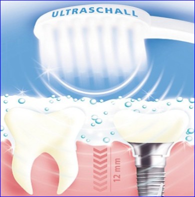 Ultraschall-Zahnreinigung